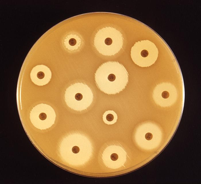 Antibiotic susceptibility test plate with zones of inhibition