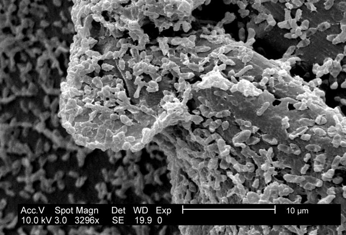 Scanning electron micrograph of Proteus mirabilis biofilm